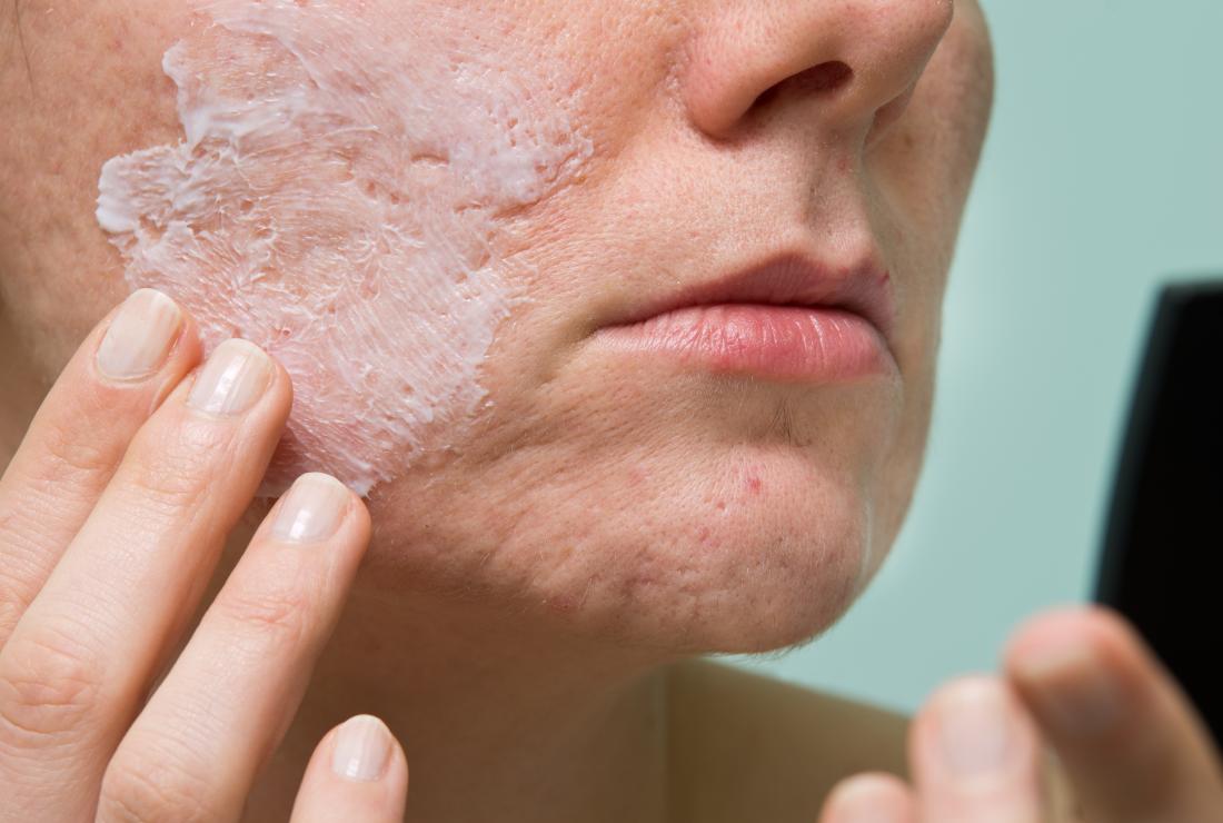 woman cleaning face with salicylic face wash to cure acne