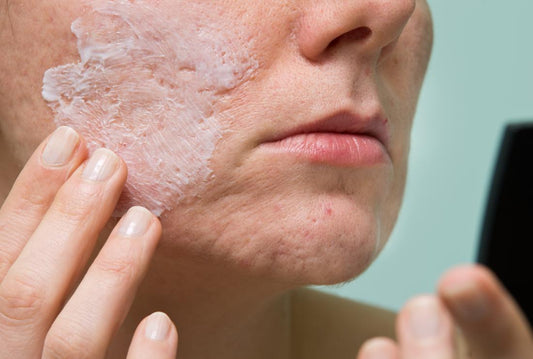 woman cleaning face with salicylic face wash to cure acne